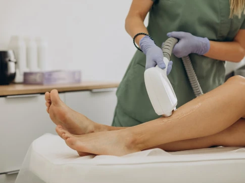 How Effective Is Laser Hair Removal in Preventing Ingrown Hair?