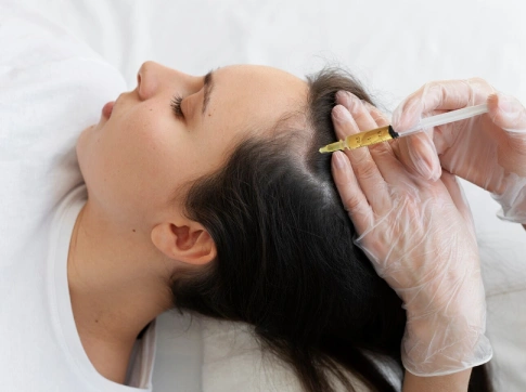 Mesotherapy Treatment: Procedure, Benefits & Uses for Hair Growth