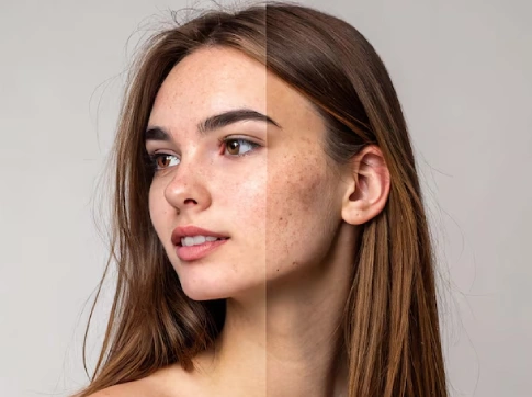 Doctor-Approved Ways to Get Rid of Hyperpigmentation Safely & Effectively