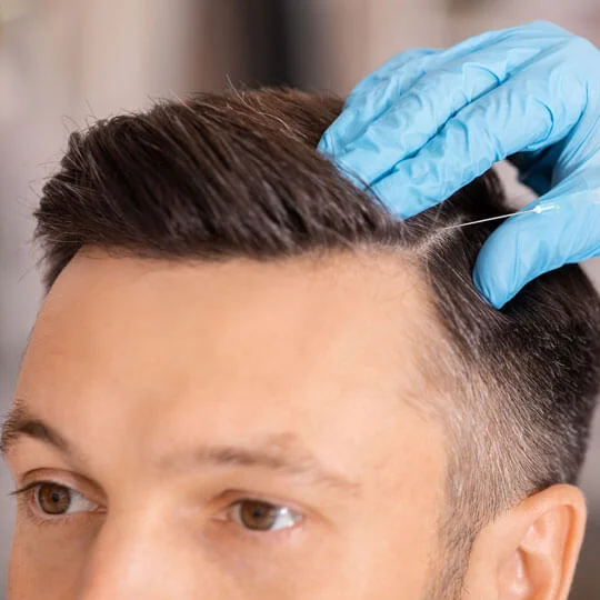 Hair Transplant Surgery in Noida