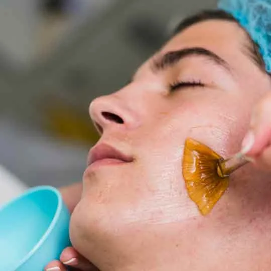 Cosmelan Peel