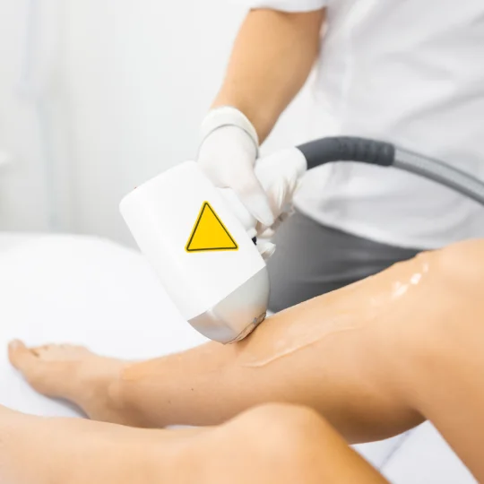 Legs Laser Hair Removal Treatment - Skinlogics Clinic