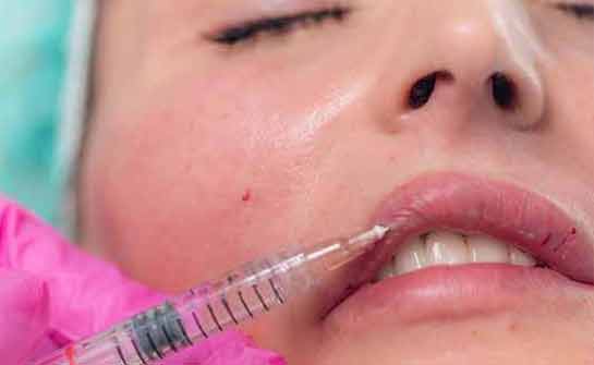 Lip Enhancement Treatment in Noida