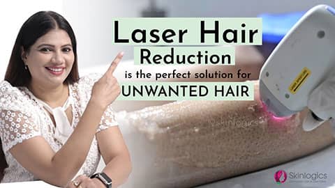 Laser Hair Reduction for Unwanted Hair Removal from Body | Skinlogics Derma Clinic