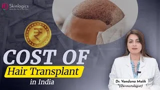 Cost of Hair Transplant in India | Best Hair Transplant in Noida | Skinlogics Clinic