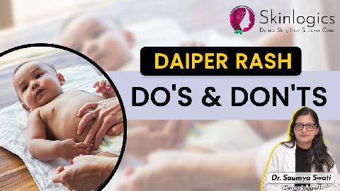 Diaper Rash Treatment | Best Skin Specialist in noida | Skinlogics Clinic
