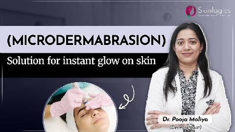 Microdermabrasion Skin Polishing Treatment by Dermatologist | Skin Polishing in Noida | Skinlogics