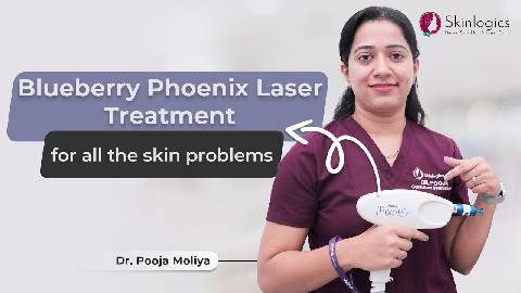 Blueberry Phoenix Laser Treatment for all the skin problems | Best Skin Clinic in Noida