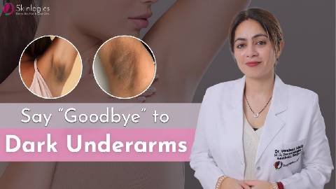 Understanding the Causes of Dark Underarms and Treatment Options | Best Dermatologist in Noida