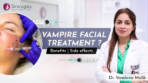 Vampire Facial Treatment (PRP) | Benefits & Side Effects | Best Dermatologist in Noida | Skinlogics