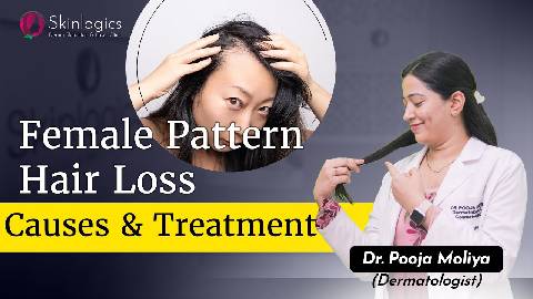 Female Pattern Hair Loss | Causes & Treatment | Hair Loss Treatment in Noida | Skinlogics Clinic