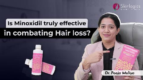Benefits and Important Considerations of Minoxidil | Does Minoxidil really work? | Skinlogics Clinic