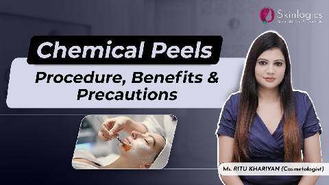 Benefits of Chemical Peels for Face