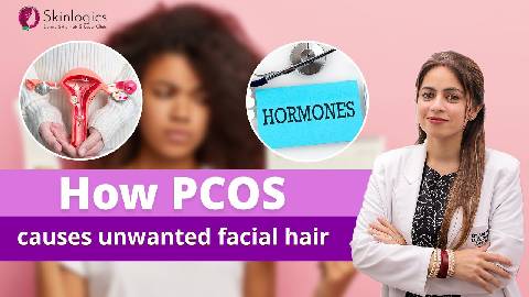 जानिये PCOS के कारण Unwanted Facial Hair क्यों होता है?