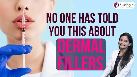 What are Dermal Fillers? | Are Dermal Fillers Safe? | Facial Fillers | Dermal Fillers in Noida