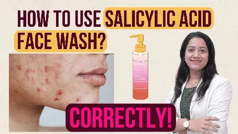 How to use Salicylic Acid Face Wash? | Salicylic Acid for Acne Prone Skin