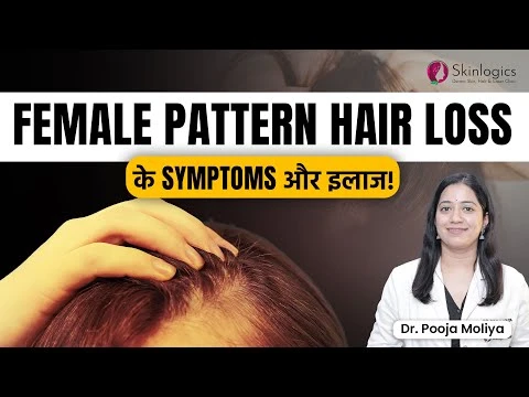 female Pattern Hair loss