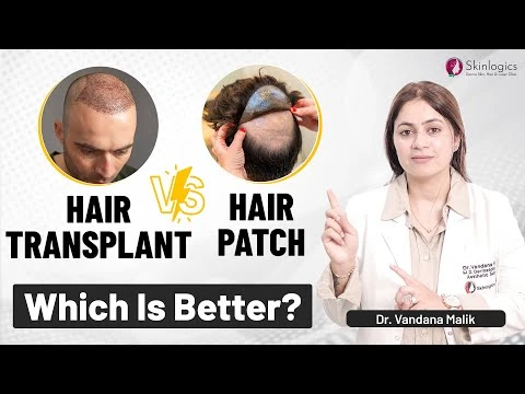 Hair Transplant vs. Hair Patch: Which one is better? | Haircare | Dr. Vandana Malik