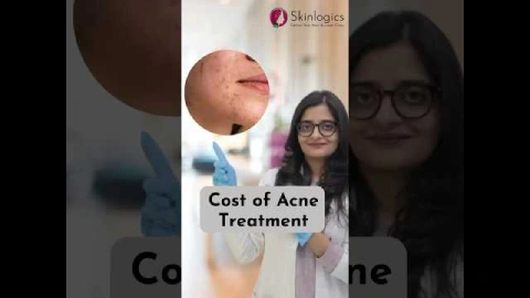 Cost of Acne Treatment | Acne Treatment in Noida | Skinlogics