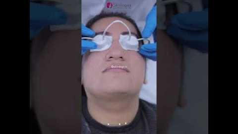 Remove Unwanted Hair From Laser Hair Reduction