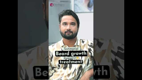 Patient Testimonial | Beard Growth Treatment | Transformational Results