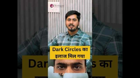 DermaFrac Treatment for Dark Circles | Dark Circle Treatment in Noida | Skinlogics Clinic