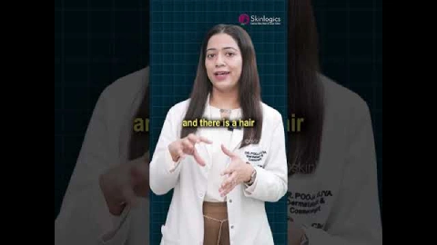 Hair Thinning in Women? Here’s What Works Best!