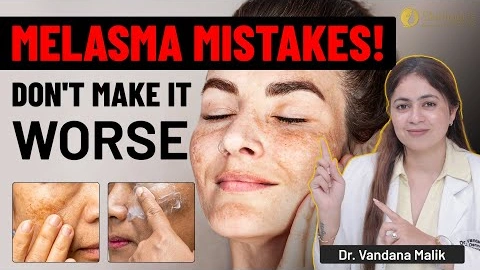 How To Get Rid Of Melasma | Melasma Explained: Causes, Types & Best Treatments | Dr. Vandana Malik