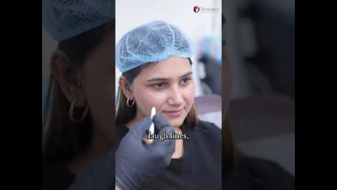 Most Common Filler Indications Explained!